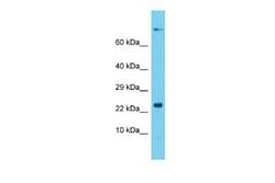 DCTN5 Rabbit anti-Rat, Polyclonal, Novus Biologicals 0.1 mL | Buy Online | Novus Biologicals | Fisher Scientific